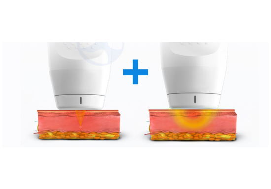Advanced Skin Tightening with 10D Care-9