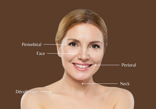 Commonly treated areas