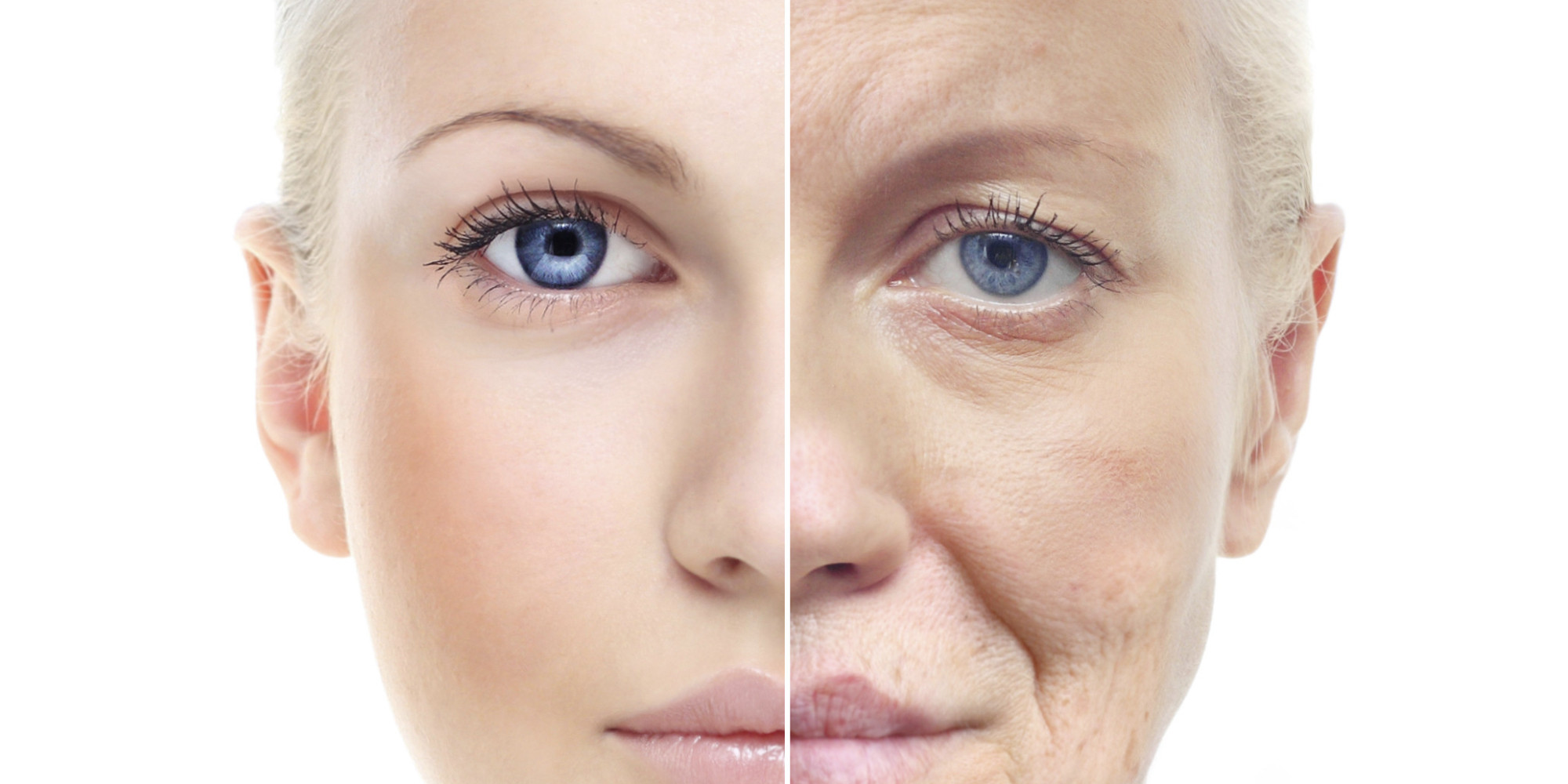 Signs of Aging and Inflammation