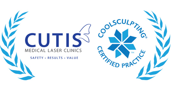 A milestone reached with CoolSculpting