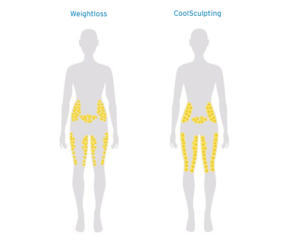 weightloss-vs-fat-reduction
