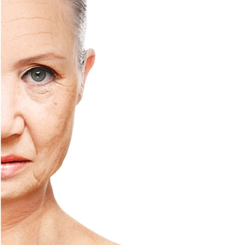 How to Prevent Wrinkles Painlessly