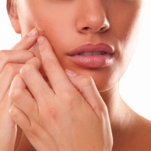 Pimple Problems Popping Up? 4 Tips in Dealing With Active Acne and Acne Scars