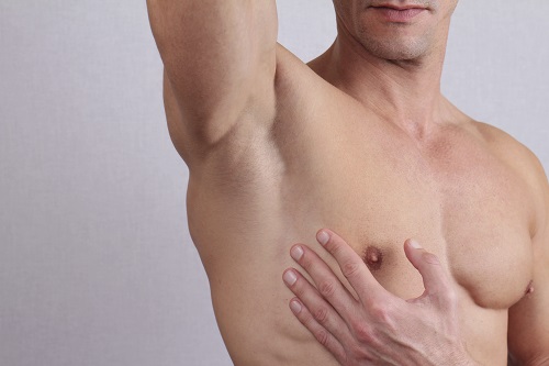 permanent hair removal