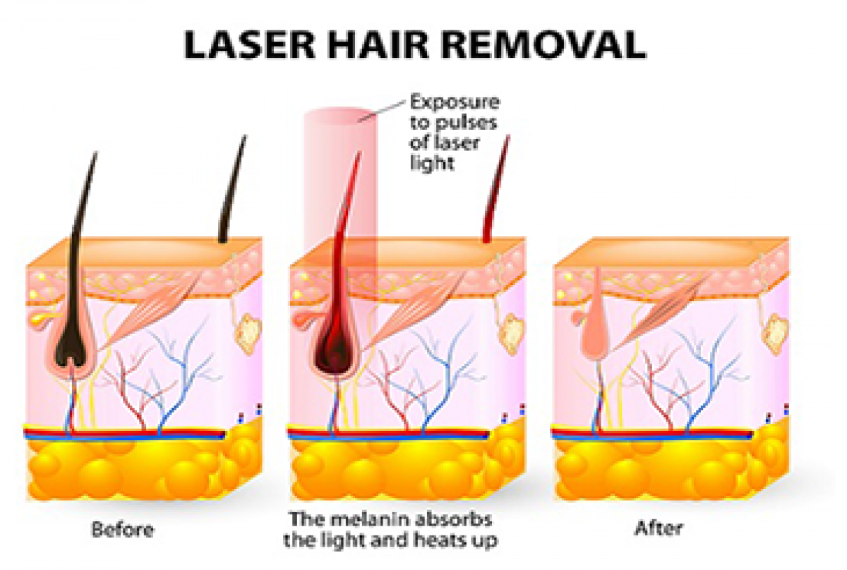 Understanding Hair Growth Cycles & Their Effects Understanding Hair Growth Cycles & Their Effects