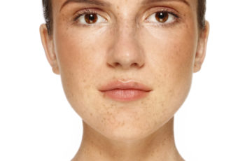 Understanding How Skin Lighteners Work: A Mini-Guide to Help You Fade Dark Spots