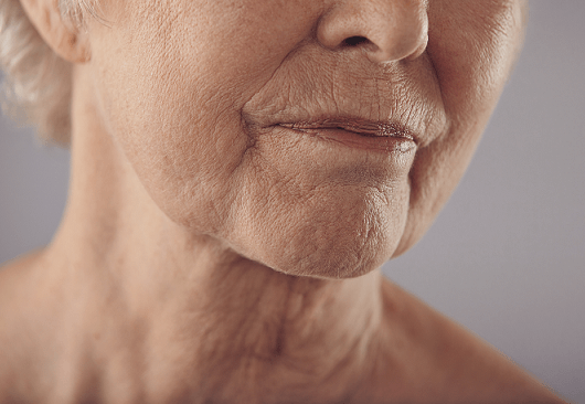 wrinkles wrinkles