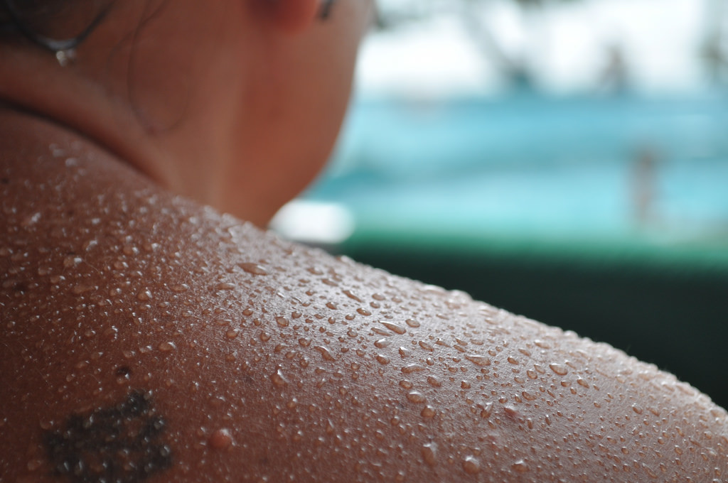 Effective Treatments for Excessive Sweating