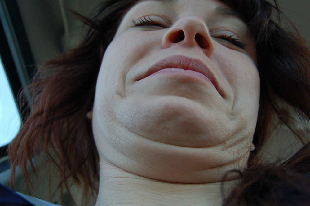 double-chin-treatments