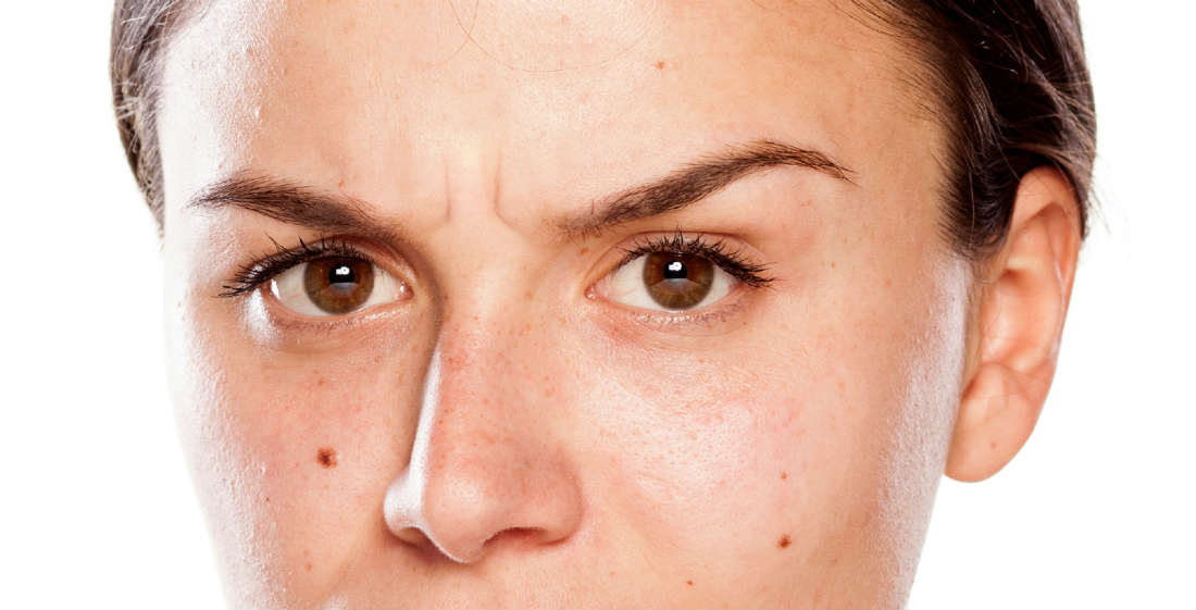 How Botulinum Toxin Can Fix an Angry Resting Face