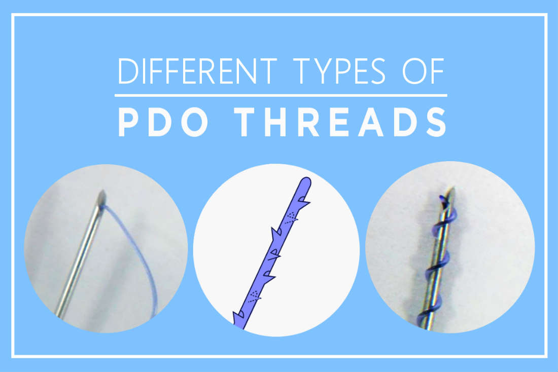 What Are the Different Types of PDO Threads in Singapore?