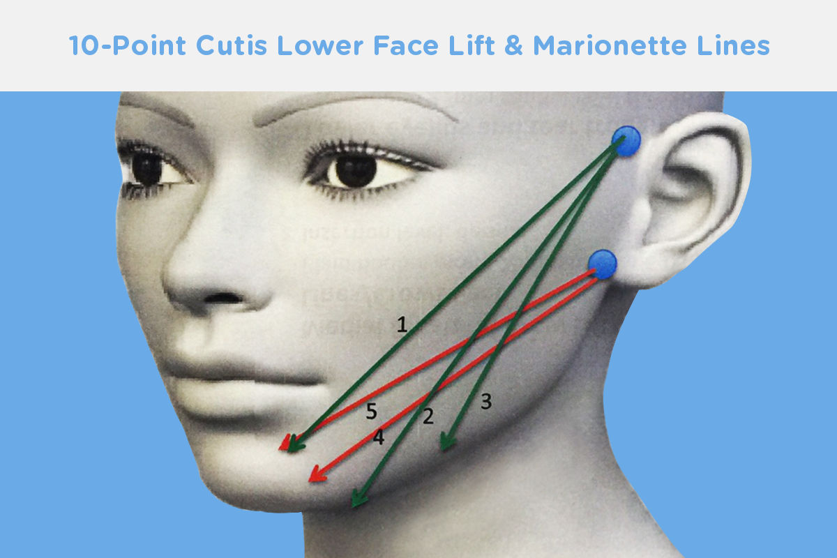 10-point-lower-lift-marionette