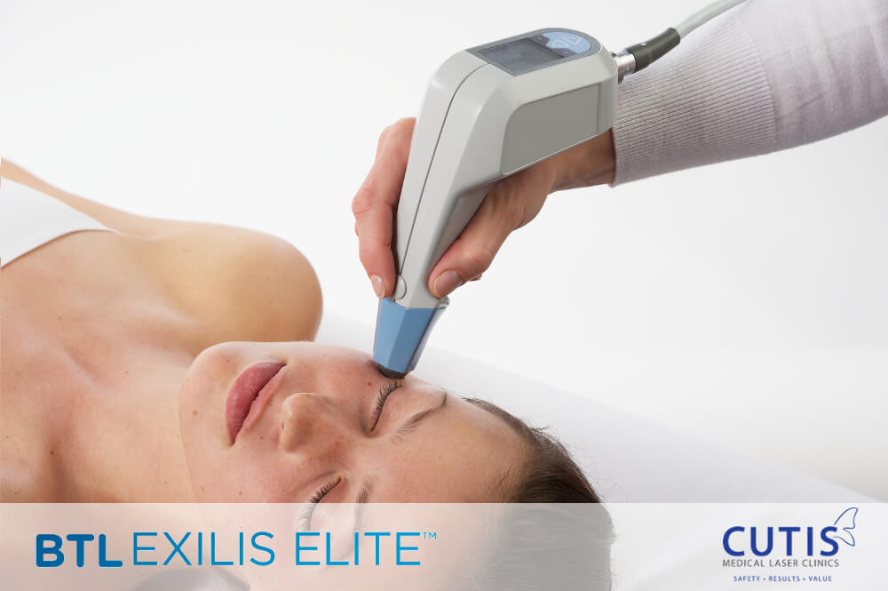 Exilis-face-logo