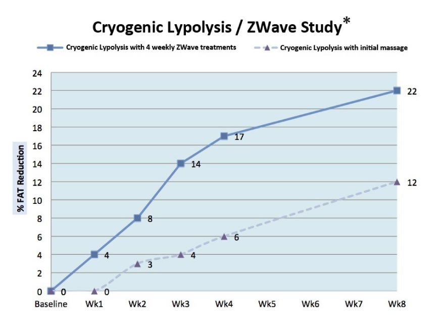 zwave-study-bigger