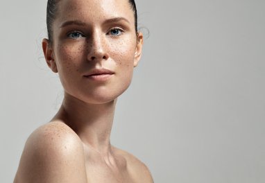Bothered by Dark Spots? Here Are 4 Effective Ways to Treat Them
