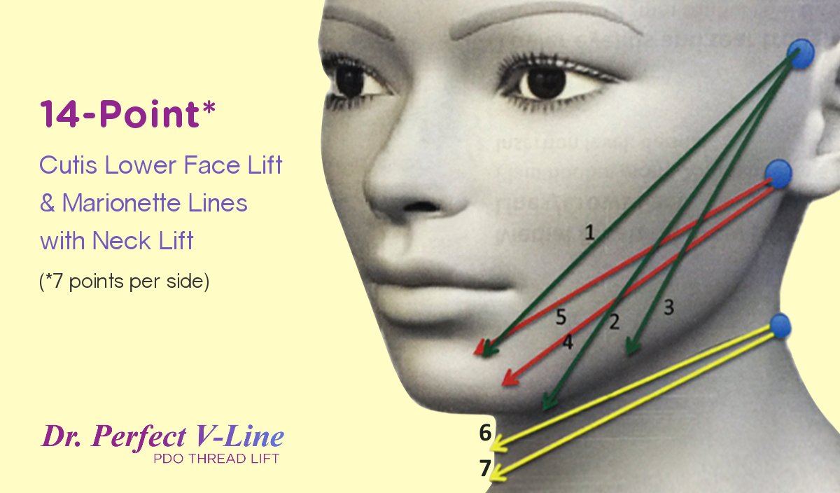 How to Achieve a Youthful V-Shape Face - Laser Clinics Singapore