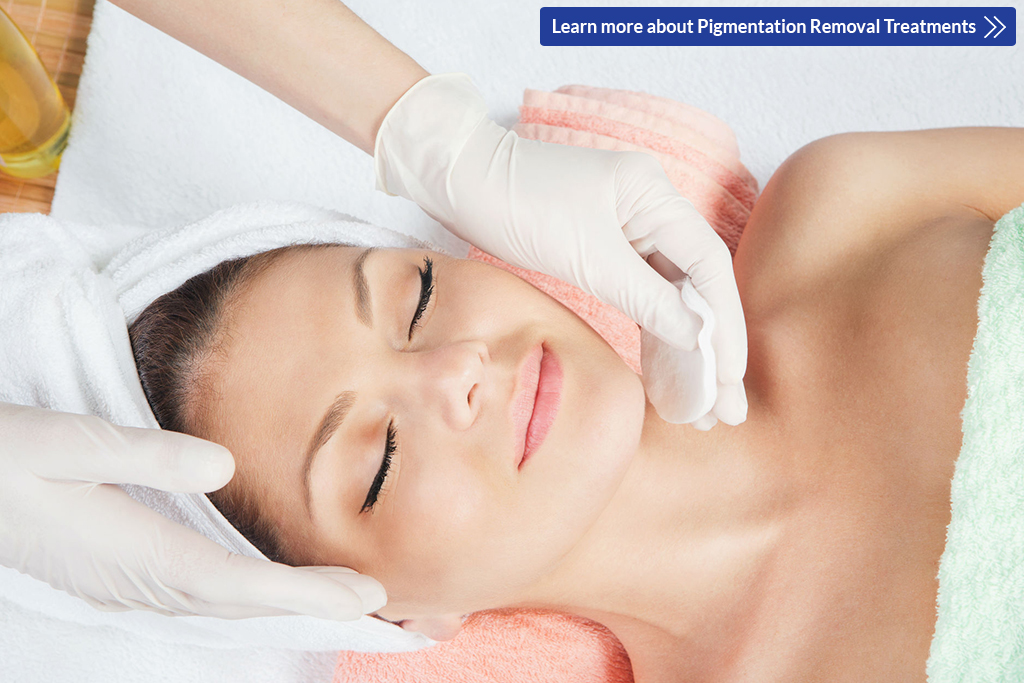 5 Safe and Effective Pigmentation Removal Treatments in Singapore
