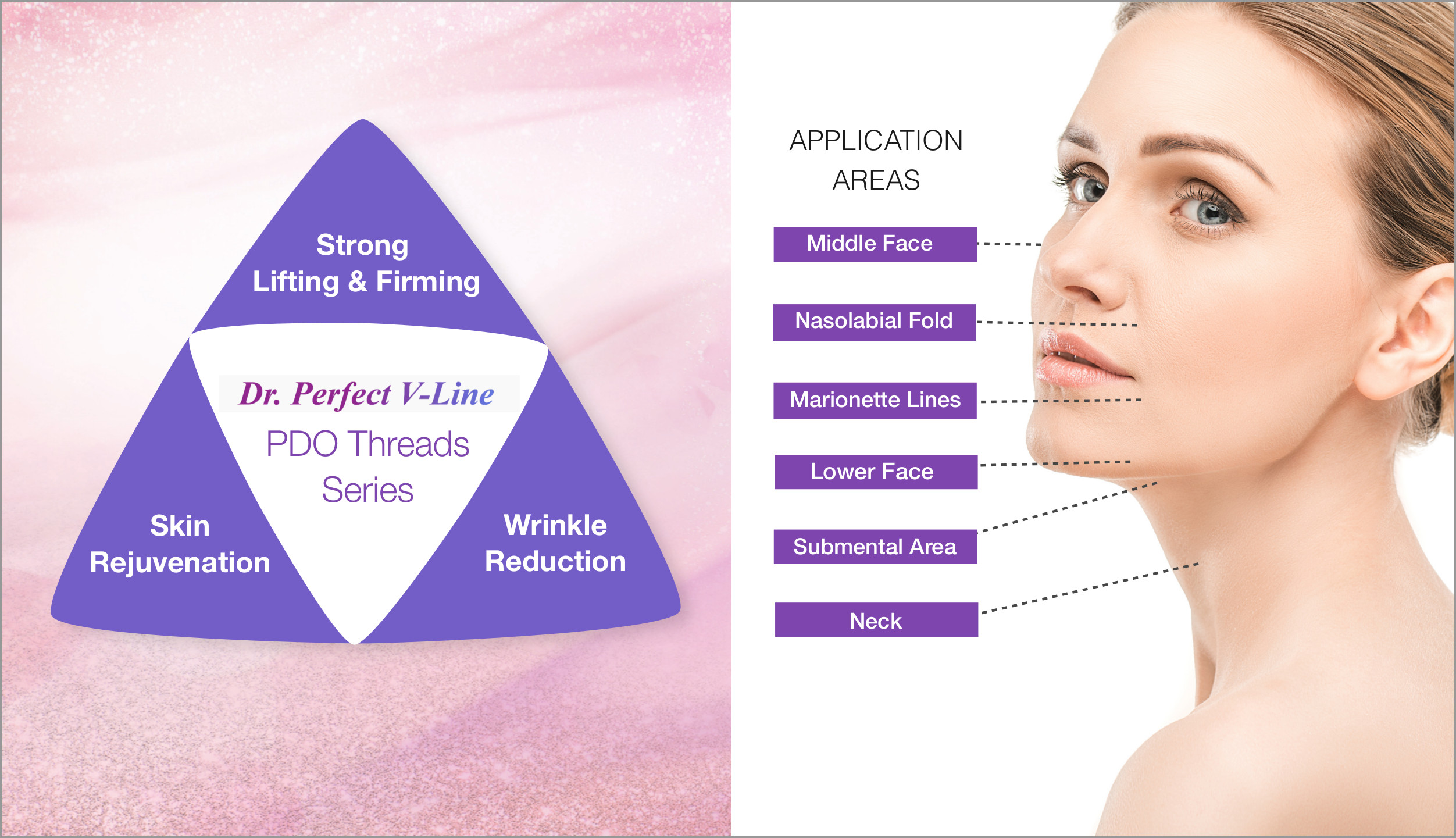 PDO Thread Lifting Procedure for Face, Neck, Eye Bags, Nose