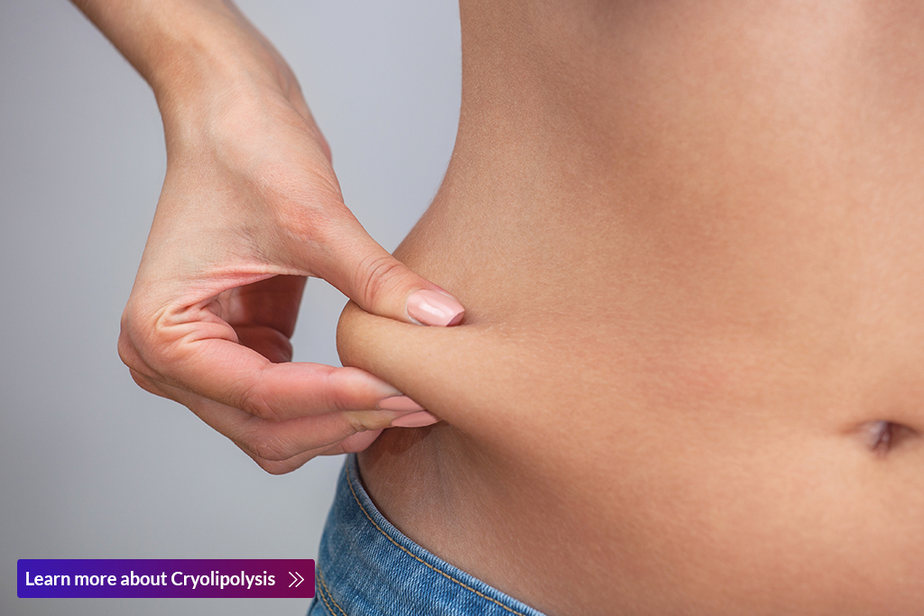What Exactly Is Cryolipolysis?