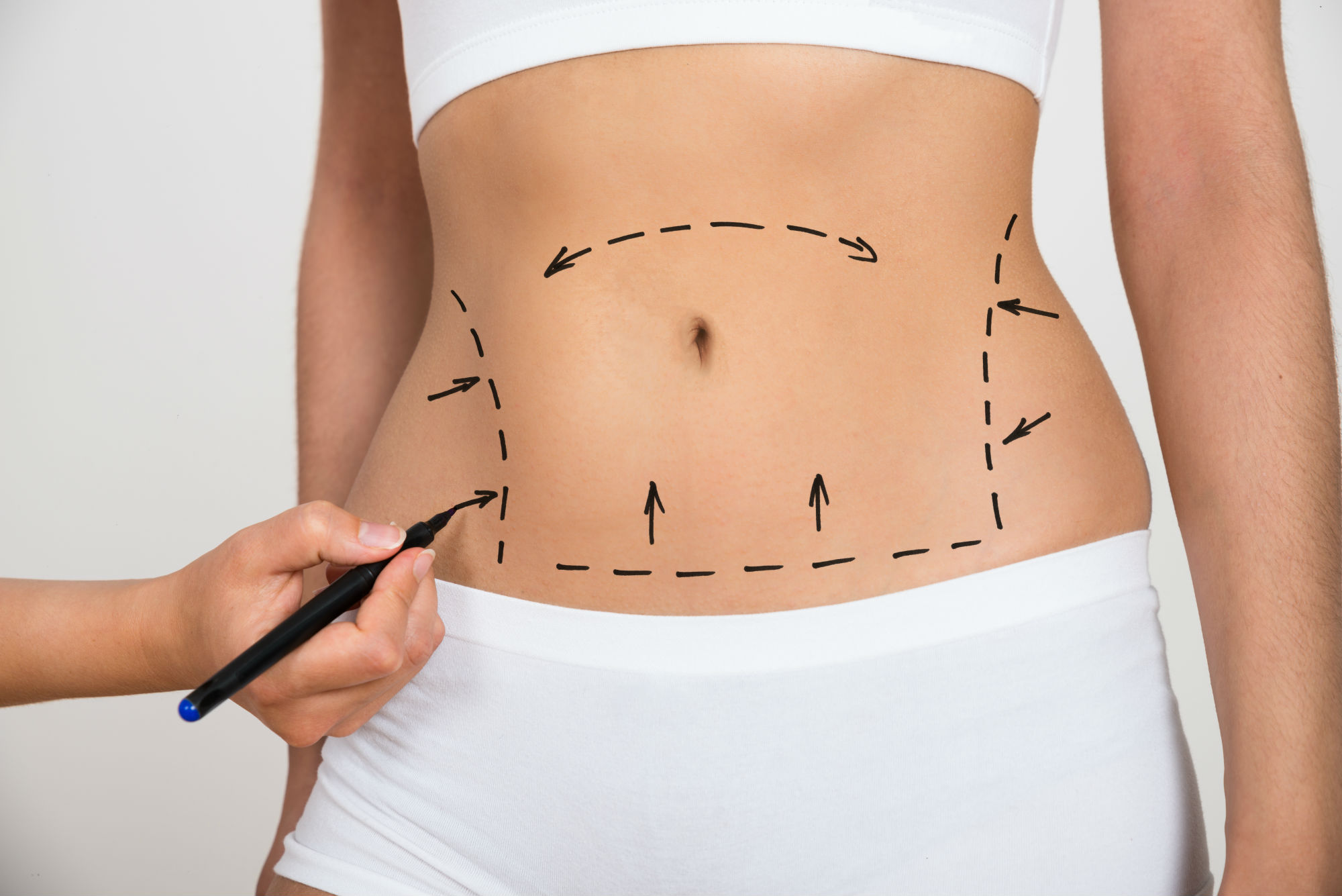 5 Ways to Tighten Loose Belly Skin