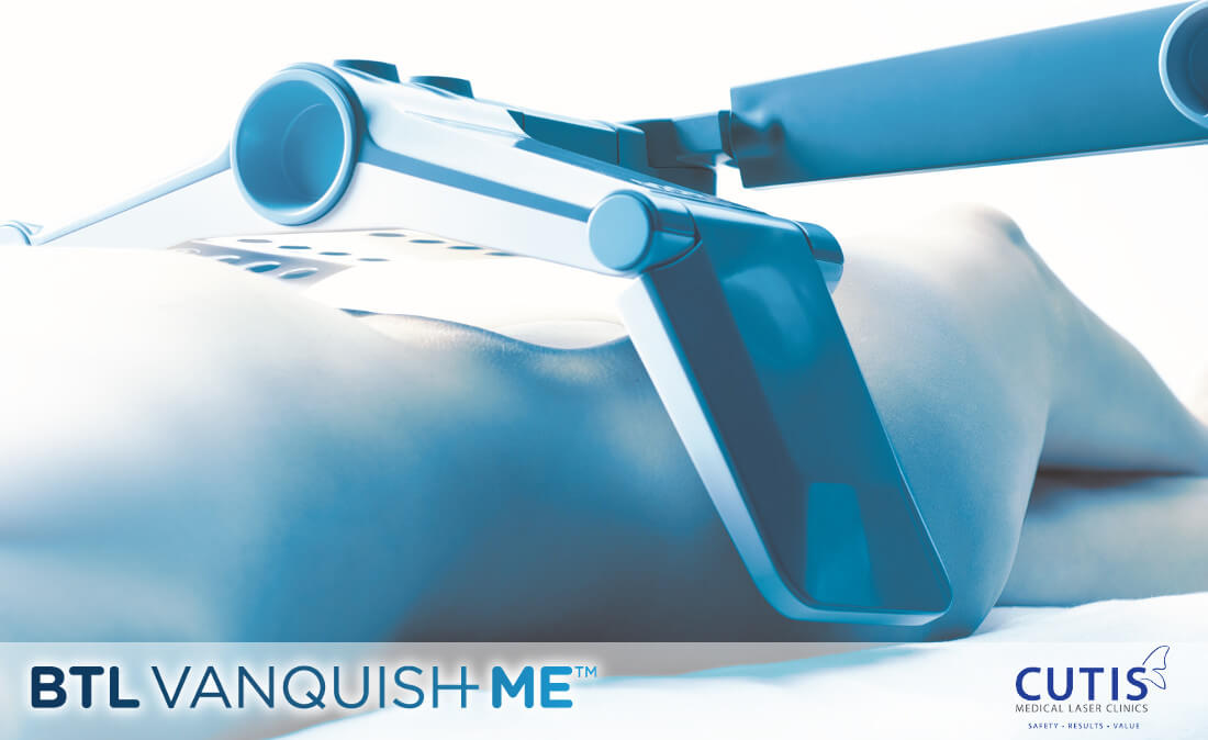 Fat Reduction via Vanquish ME’s Fat Melting Technology: Is it Effective?