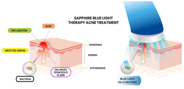 How Sphirpe Works?