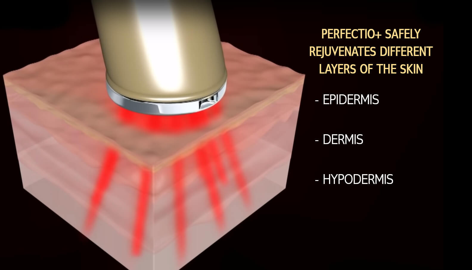 Perfectio-red-light-1