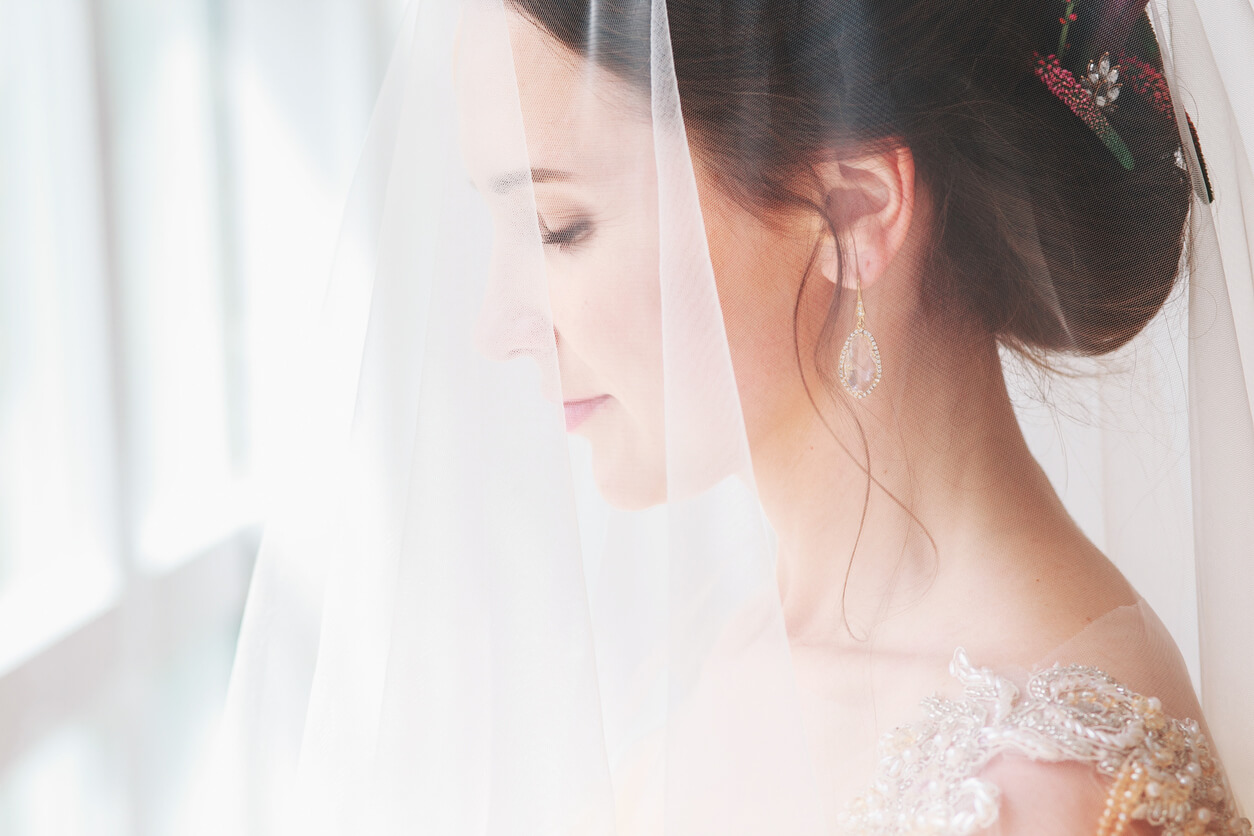 Look Your Best in Your Wedding: Pre-Bridal Aesthetic Treatments and When to Schedule Them