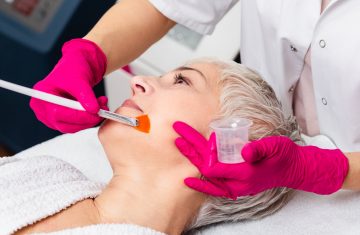 Discover the Effectiveness of Chemical Peels to Reduce Acne Scars