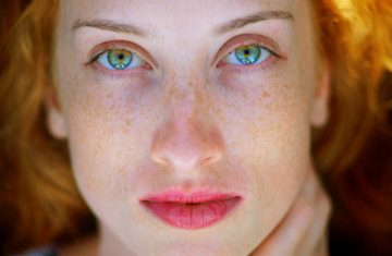 Is it Possible to Reverse the Effects of Sun Damage?