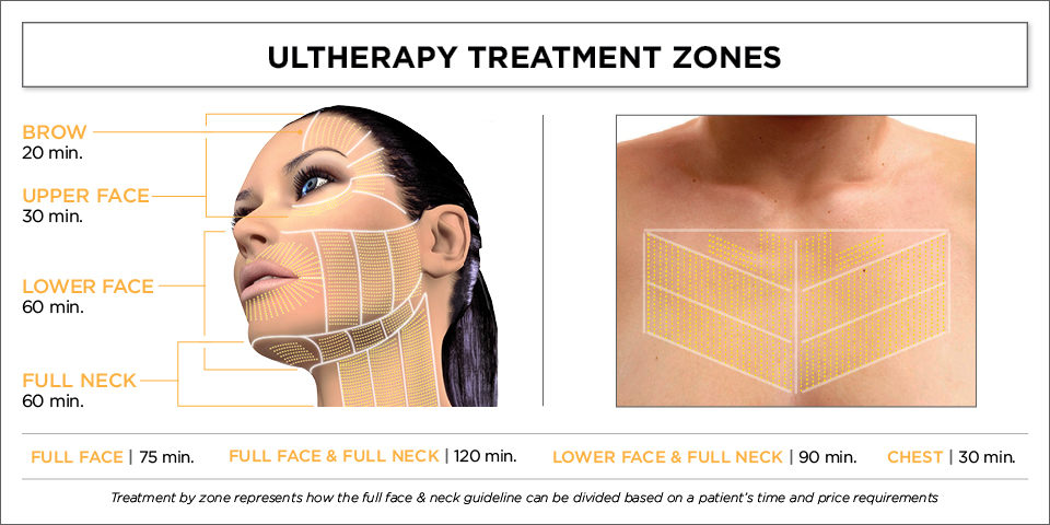 Ultherapy treatment zones