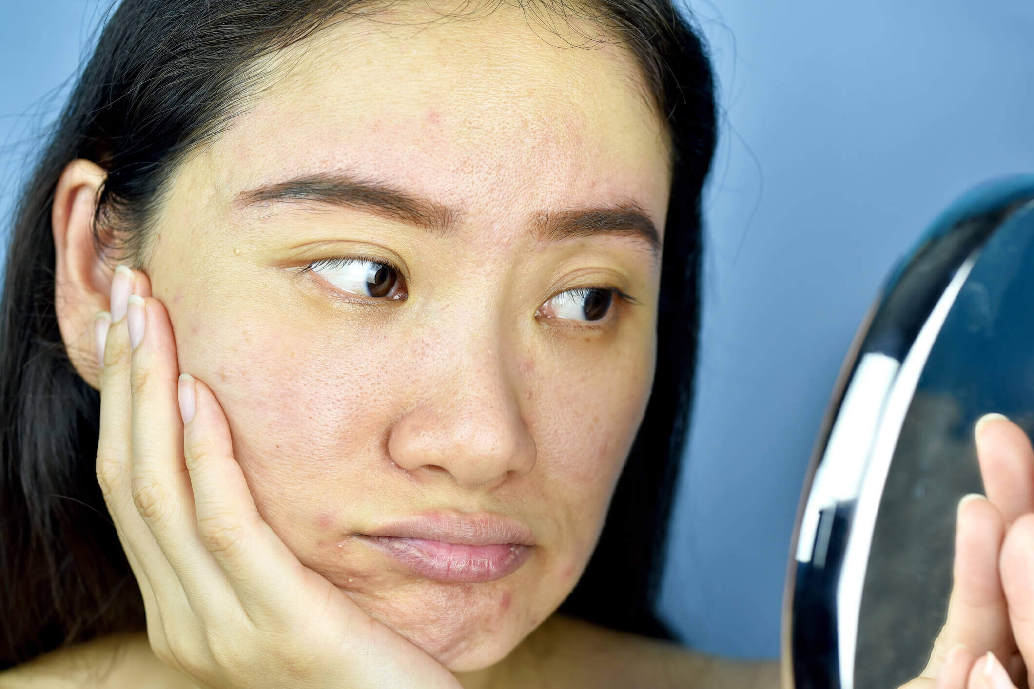 Clogged Pores: Why It Happens and What You Can Do About It Clogged Pores: Why It Happens and What You Can Do About It