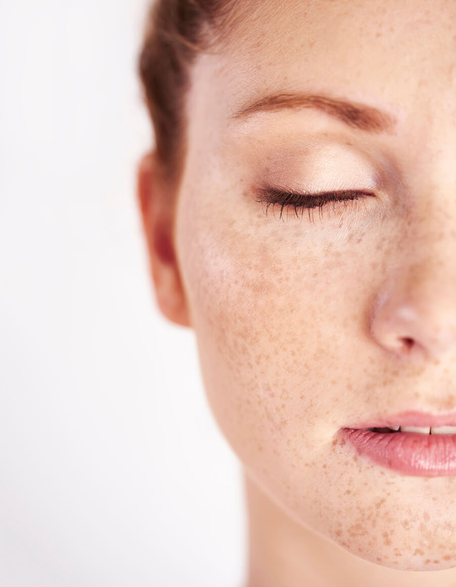 Dark Spots on Skin: Aesthetic Treatments for Fading Hyperpigmentation