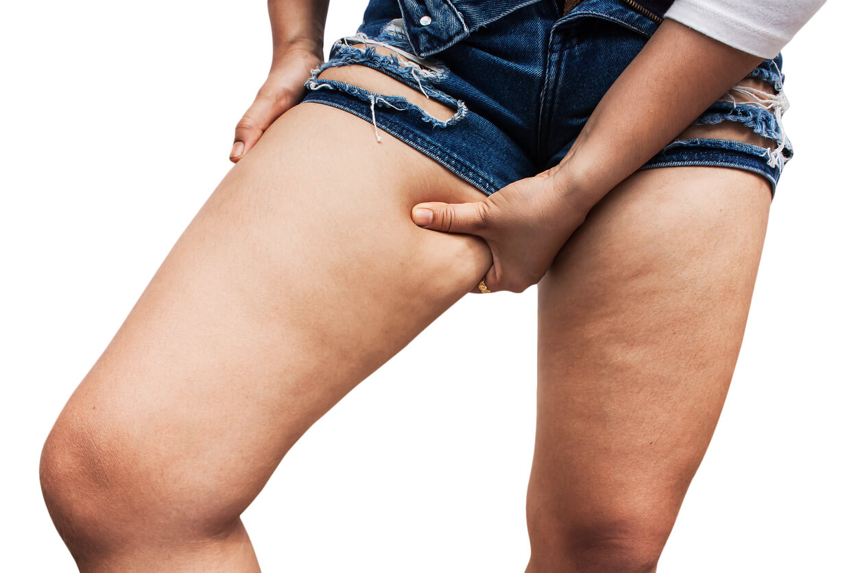 Reducing Cellulite Appearance: What’s Worth Trying?