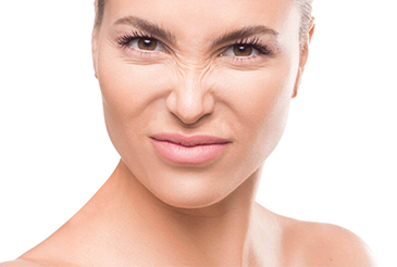 Bunny Lines: What Can You Do About Nose Wrinkles?