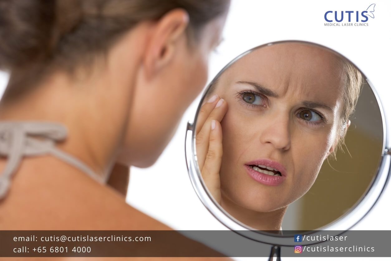 Prevent-or-Delay-Wrinkles-Cutis-Laser-Clinics