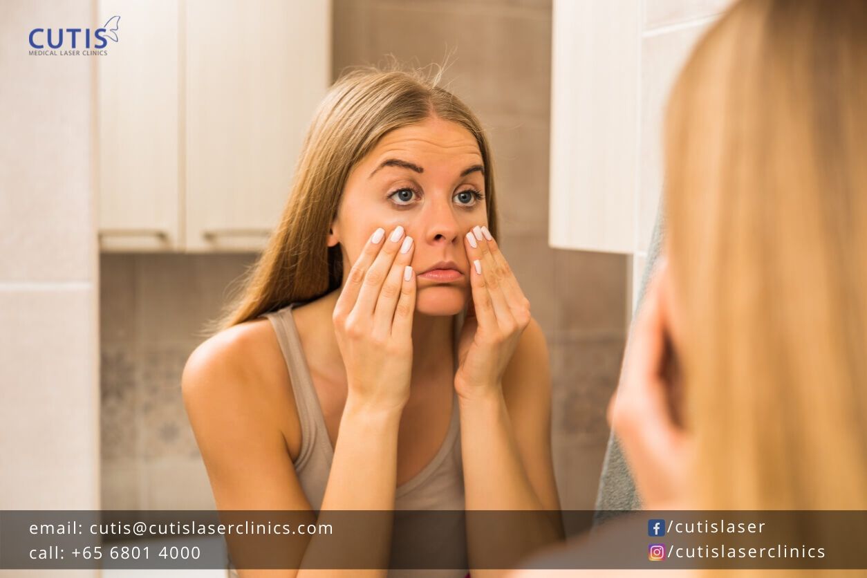 What to Do About Puffy or Swollen Eyes After Waking Up