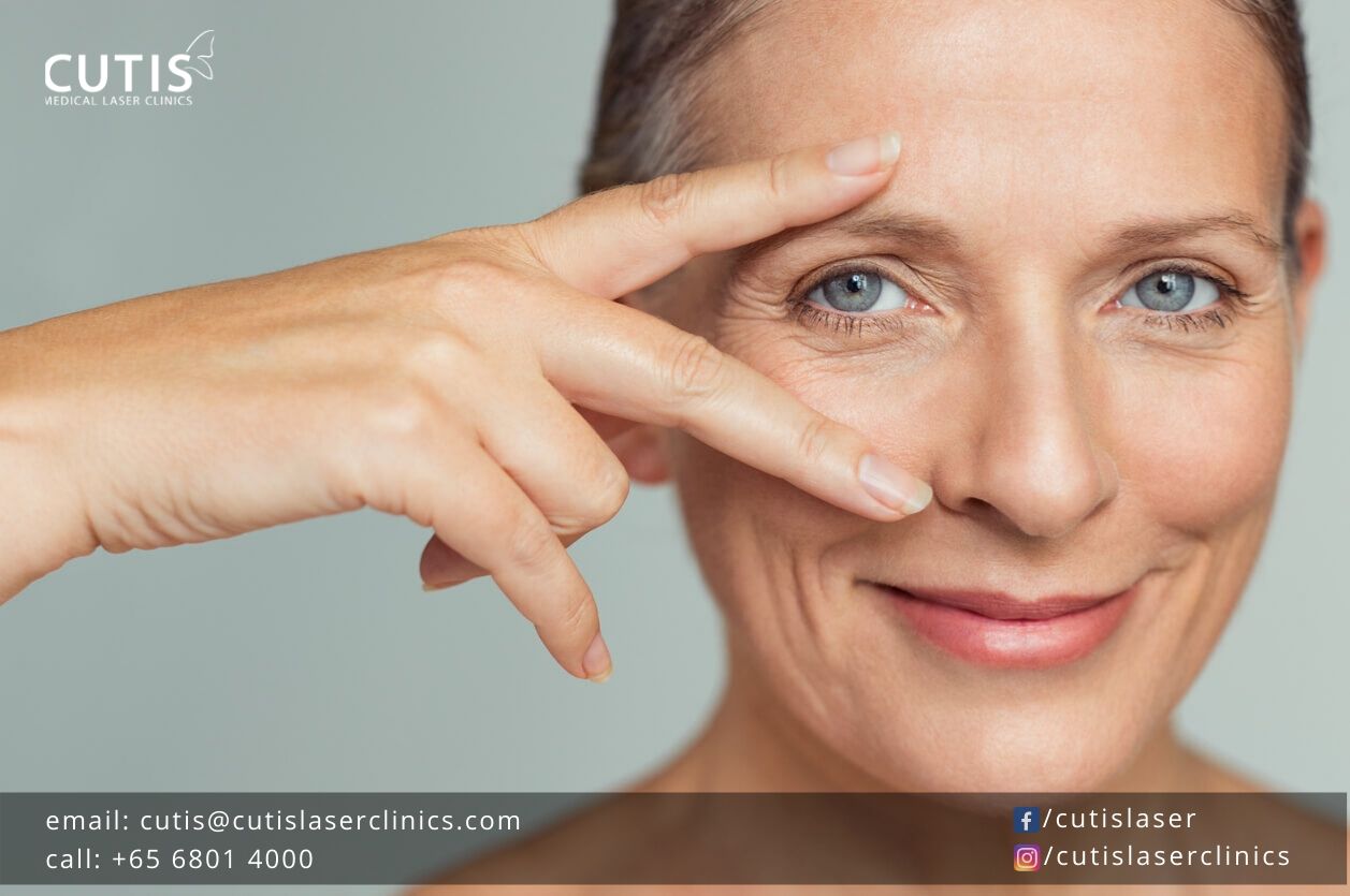 For More Youthful Eyes: Your Nonsurgical Options for Droopy Eyelids