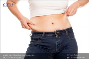 Exploring Vanquish ME for Non-Invasive Fat Reduction