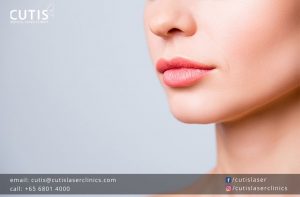 Lip Fillers: Not Just for Thin Lips