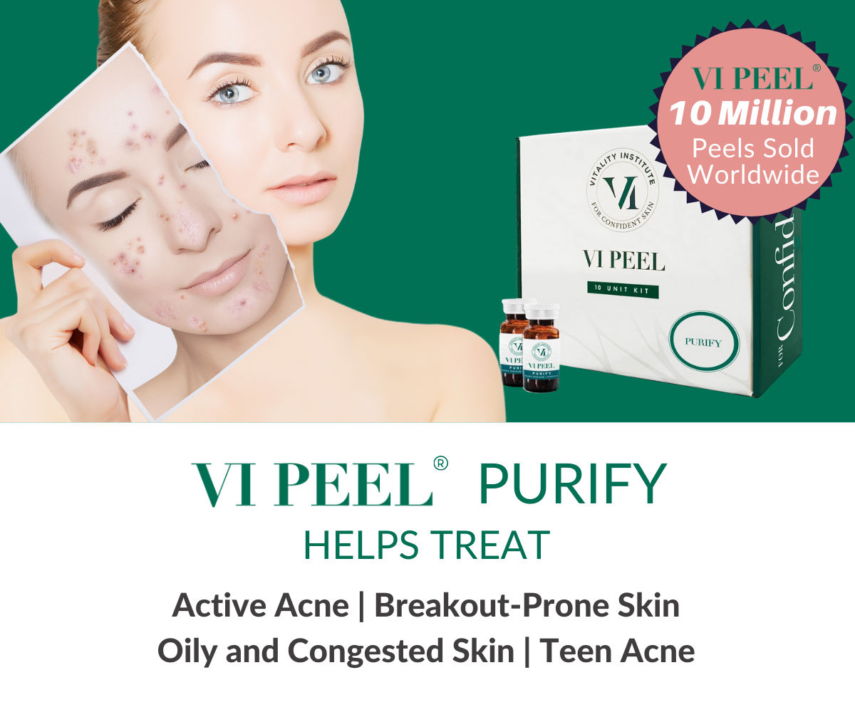 VI-Peel-Purify