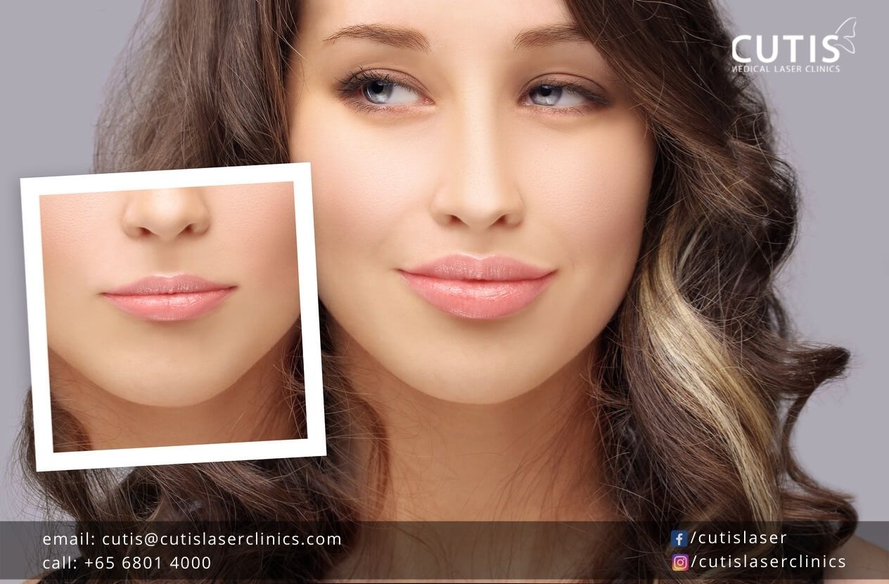 Caring for Your Lips After Dermal Fillers