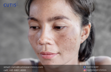 Do You Have Congested Skin?