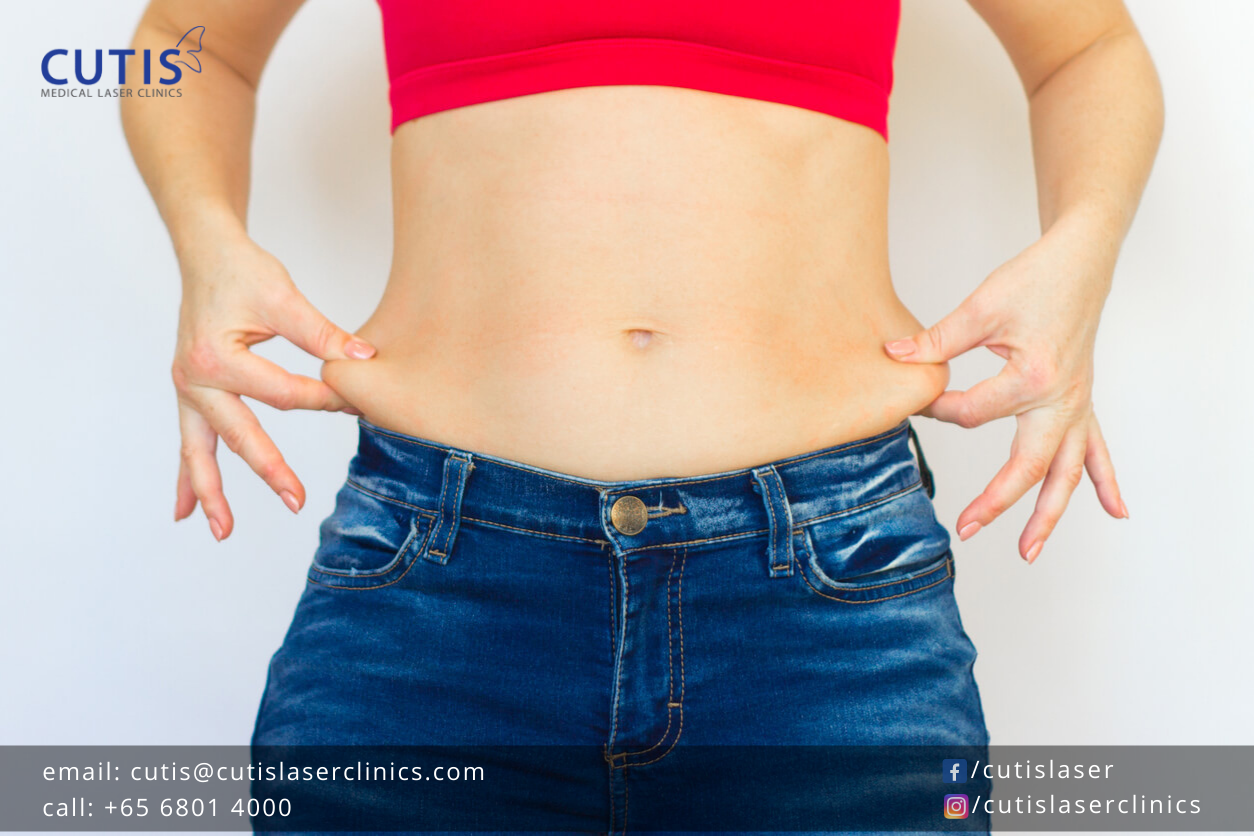 Is There a Way to Lose Your Muffin Top? Cutis Laser Clinics in