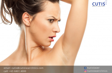 Armpit Discoloration: Is Your Deodorant to Blame?