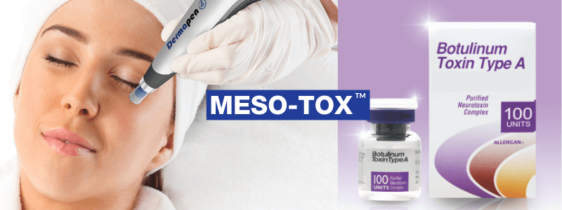Meso-Tox Treatment in Singapore