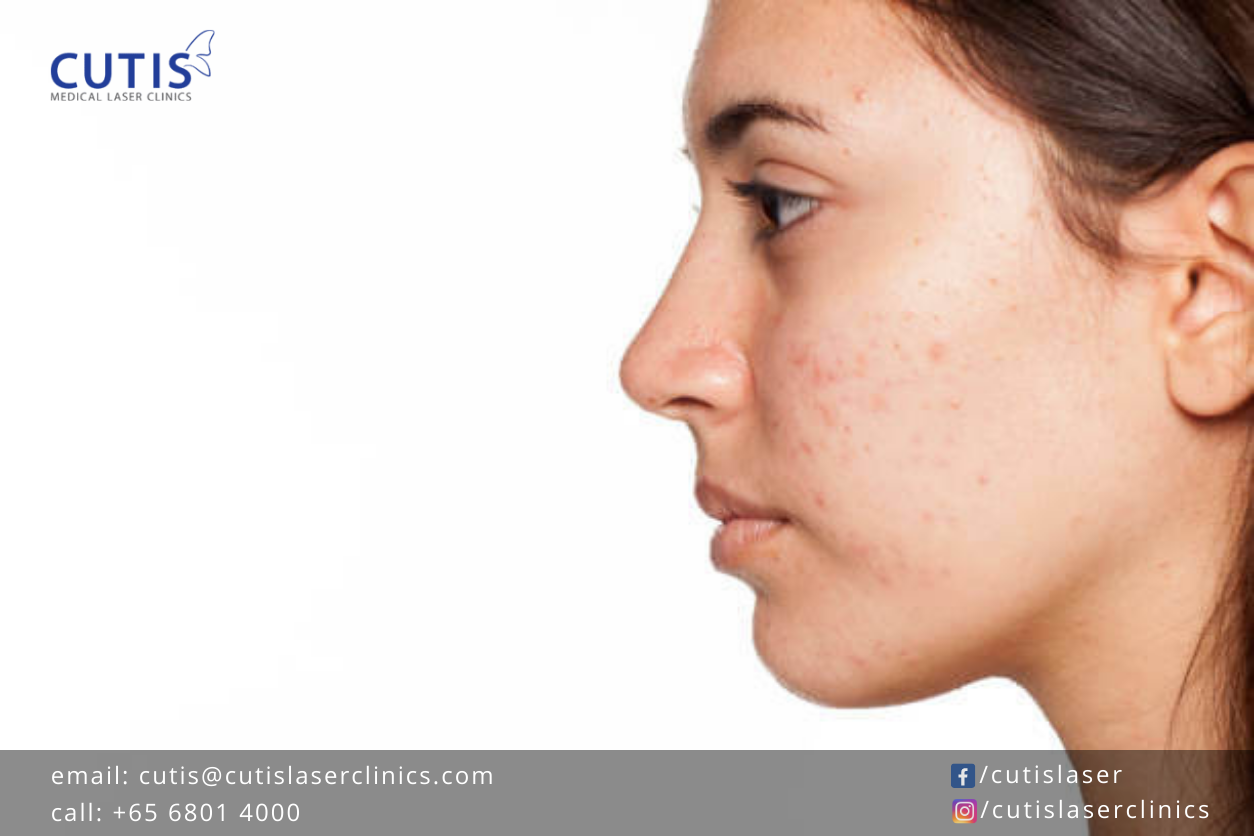Treating-Scars-and-Pigmentation-PicoLaser-vs-Traditional-Lasers