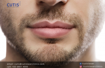 Lip Fillers for Men: Things You Should Know