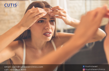 For Women: 5 Common Skin Concerns and How to Deal with Them