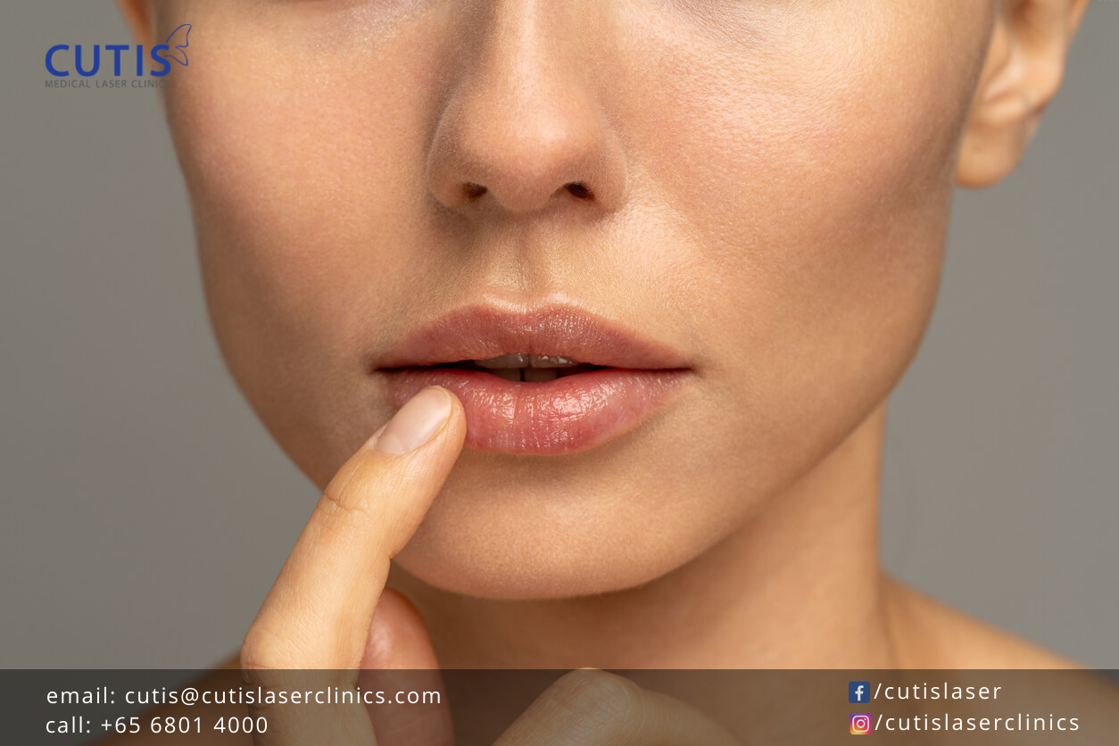 Smooth Lips: Singapore's Topical Treatments for Lip Wrinkles